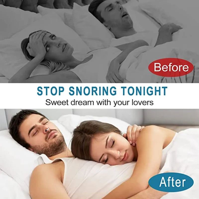 Portable Anti Snoring Device for Men and Women